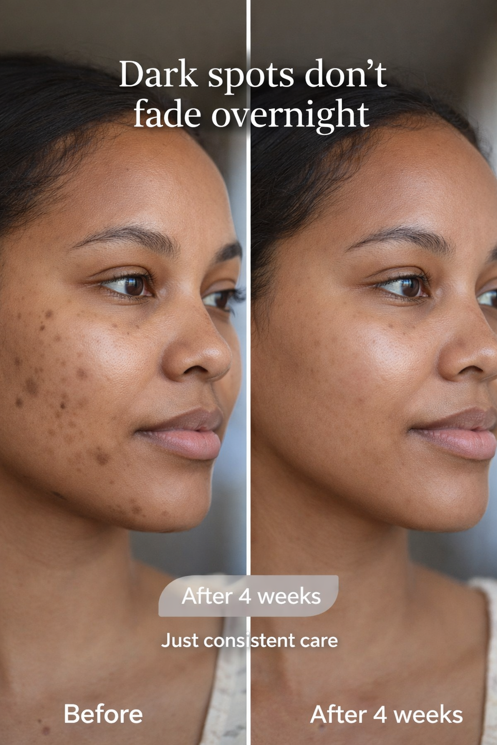 Brightening Dark Spot Routine (Kojie San Skin Lightening Soap • The Ordinary Alpha Arbutin 2% + HA • Fair & White So White! Skin Perfector Crème)