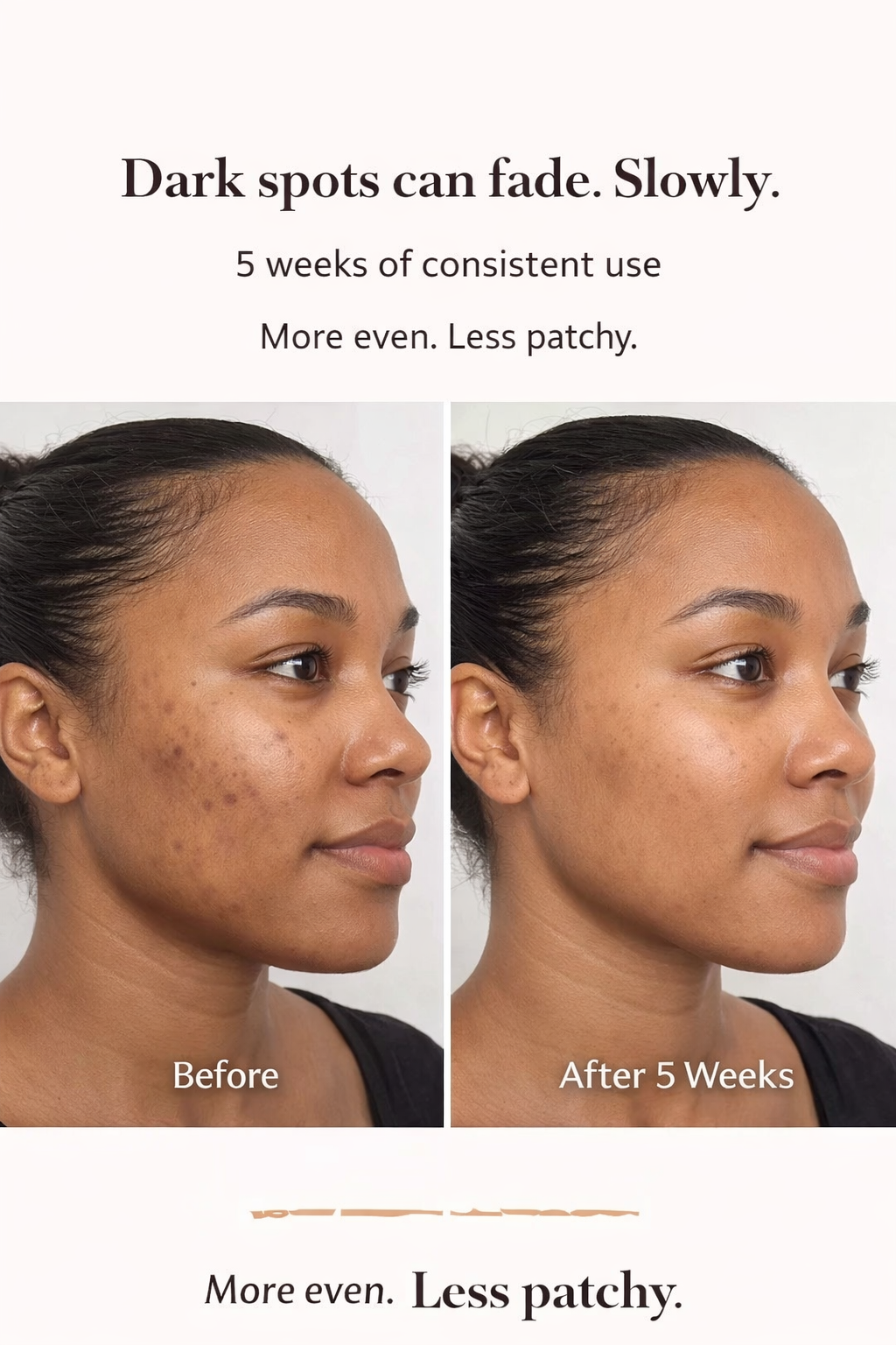 Ambi Fade Cream for Oily Skin (3PCS)