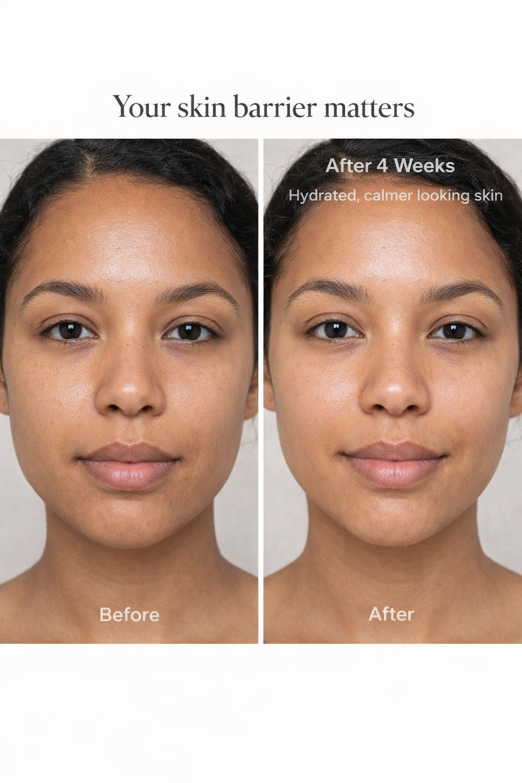 Barrier Repair & Hydration Routine (CeraVe Hydrating Cleanser • The Ordinary Hyaluronic Acid 2% + B5 • CeraVe Moisturizing Cream • La Roche-Posay Cicaplast Baume B5+)