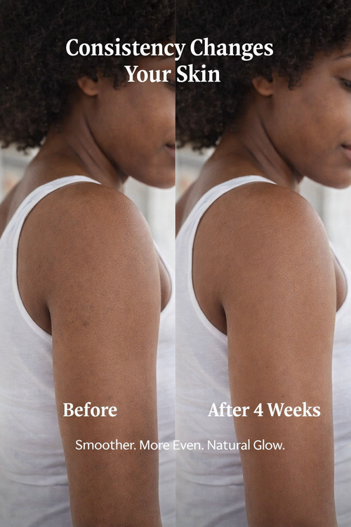 Bismid Exclusive Whitening MegaBlast Body Cream(3pcs Set)