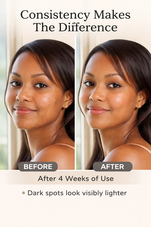 Carotone Brightening Trio (Brightening Soap • B.S.C Black Spot Corrector Serum • Brightening Cream 3-in-1 Formula)